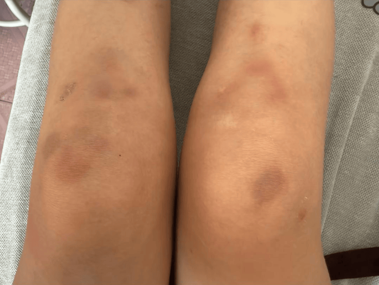 女子自称因工资问题被老板锁办公室里打 警方：双方已到派出所<strong></p>
<p>tp钱包安卓版下载</strong>，是否打人还在调查