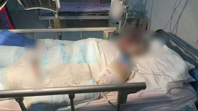 父子在哈尔滨一亲戚公司上班遇爆炸全身烧伤<strong></p>
<p>tp钱包官方网站</strong>，治疗花费近百万公司拒赔偿？亲戚回应