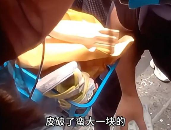 看着都疼<strong></p>
<p>tp钱包在国内合法吗</strong>！上海街头一男子突然求助：10岁女儿被死死卡住！这个行为太危险→