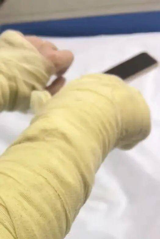 湖南一女主播被伪装的包裹炸伤<strong></p>
<p>tp钱包在国内合法吗</strong>，永州公安：正在核实具体情况