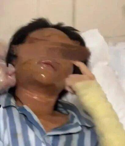湖南一女主播被伪装的包裹炸伤<strong></p>
<p>tp钱包在国内合法吗</strong>，永州公安：正在核实具体情况