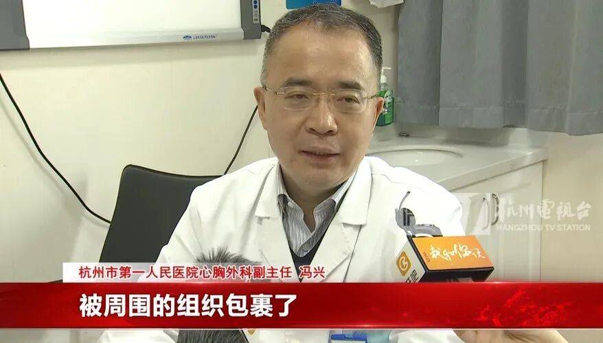 17岁小伙参军体检发现胸腔内有根5cm缝衣针<strong></p>
<p>比特儿海外版官网下载</strong>,父母回忆或是1岁时扎入,取出时已锈迹斑斑